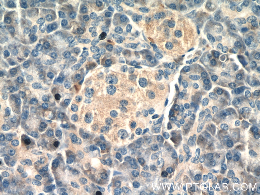 IHC staining of human pancreas using 21445-1-AP