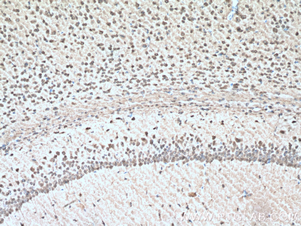IHC staining of mouse brain using 21445-1-AP
