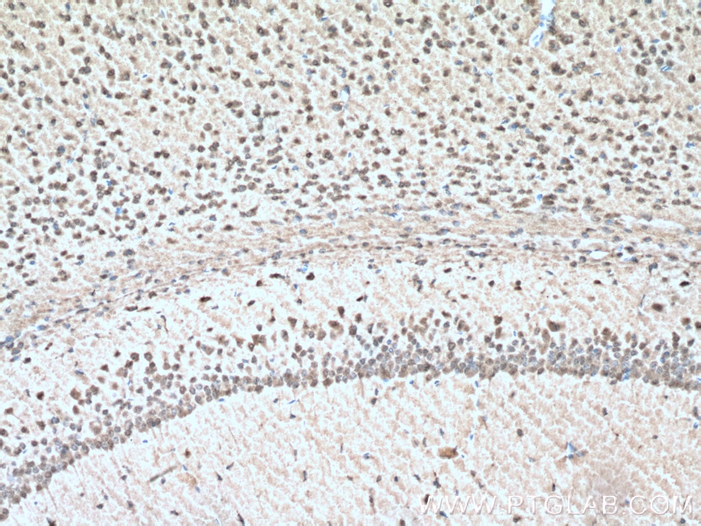 Immunohistochemistry (IHC) staining of mouse brain tissue using DDRGK1 Polyclonal antibody (21445-1-AP)