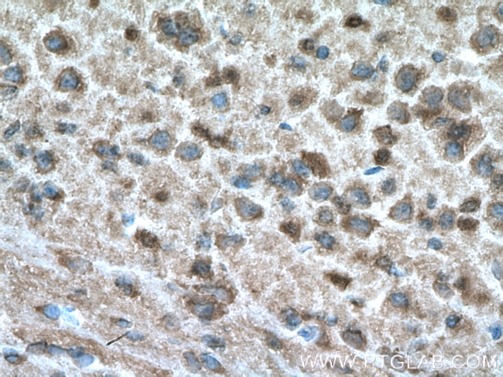 Immunohistochemistry (IHC) staining of mouse brain tissue using DDRGK1 Polyclonal antibody (21445-1-AP)