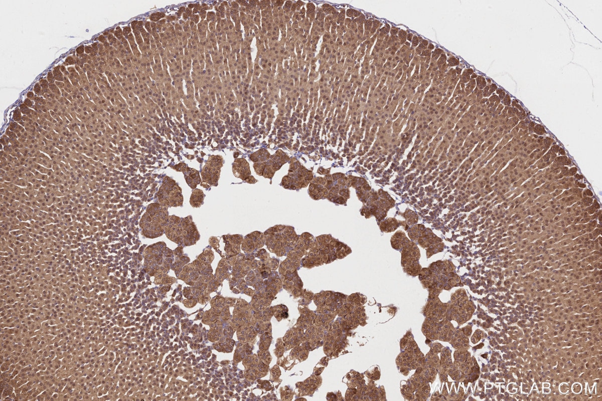 Immunohistochemistry (IHC) staining of mouse adrenal gland tissue using DDRGK1 Polyclonal antibody (21445-1-AP)