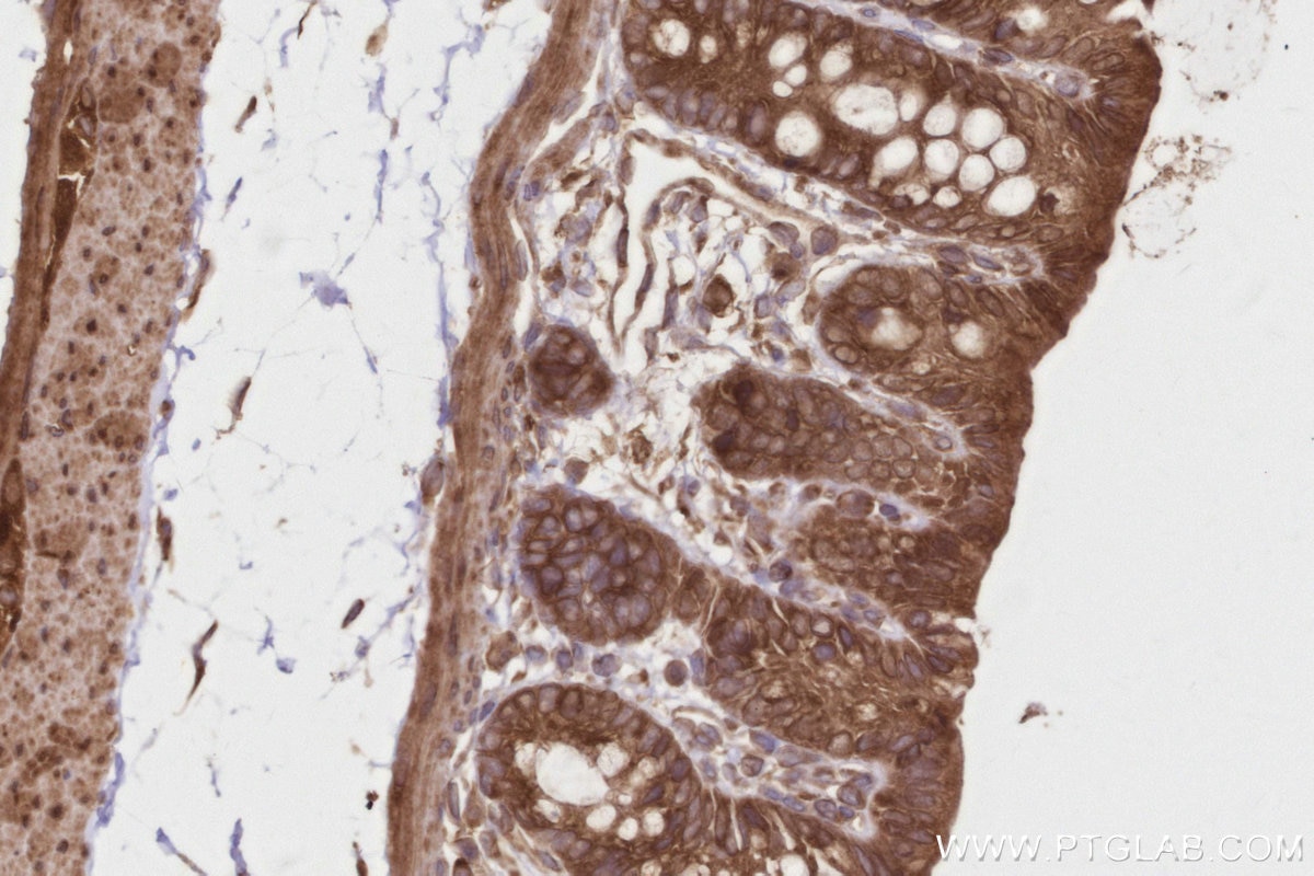Immunohistochemistry (IHC) staining of rat colon tissue using DDRGK1 Polyclonal antibody (21445-1-AP)