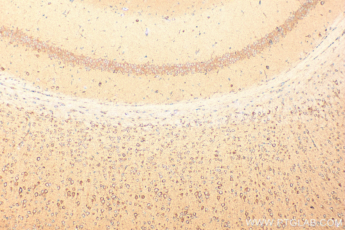 Immunohistochemistry (IHC) staining of mouse brain tissue using DDRGK1 Polyclonal antibody (21445-1-AP)