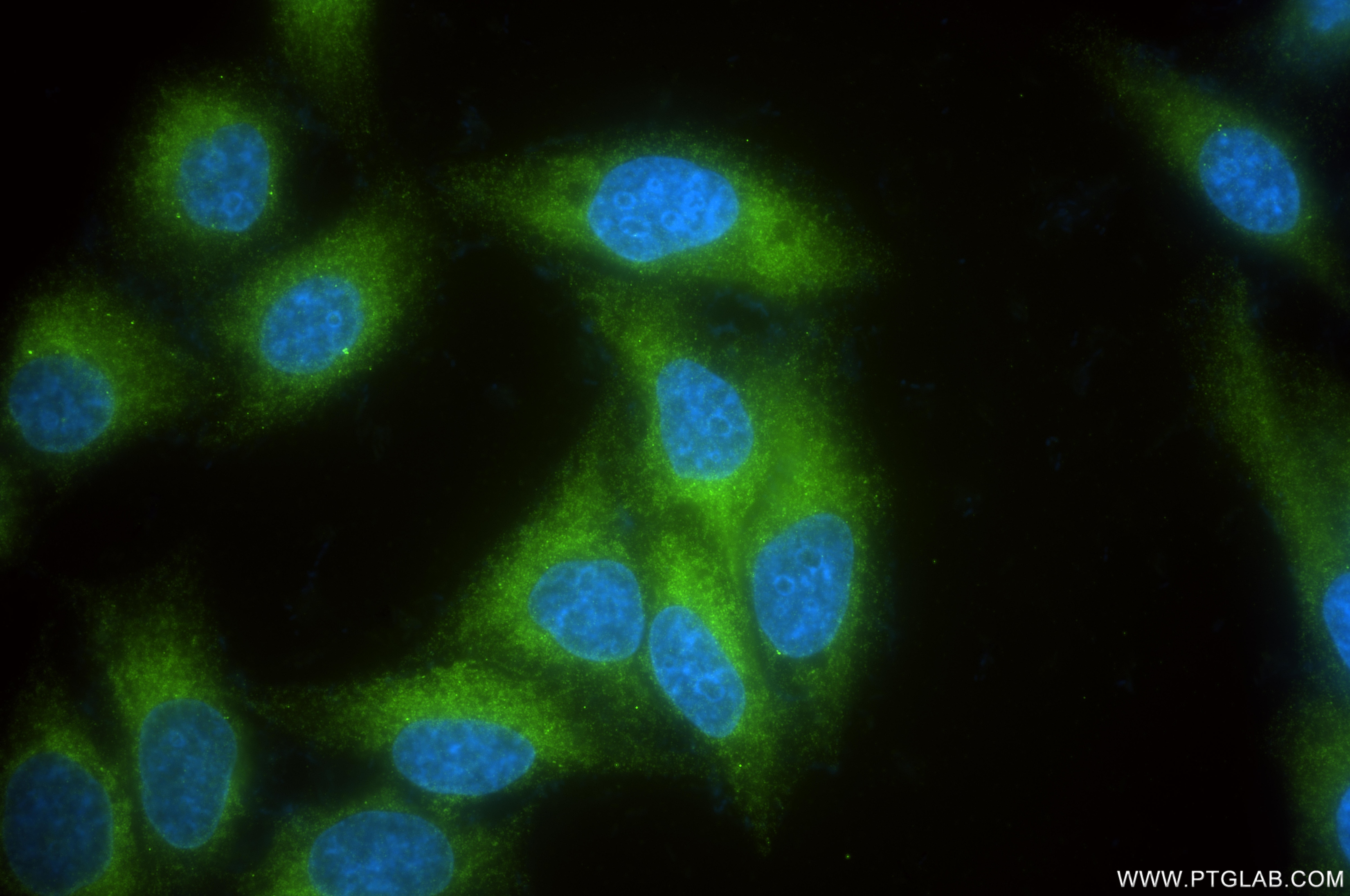 Immunofluorescence (IF) / fluorescent staining of HepG2 cells using DDRGK1 Recombinant monoclonal antibody (86667-2-RR)