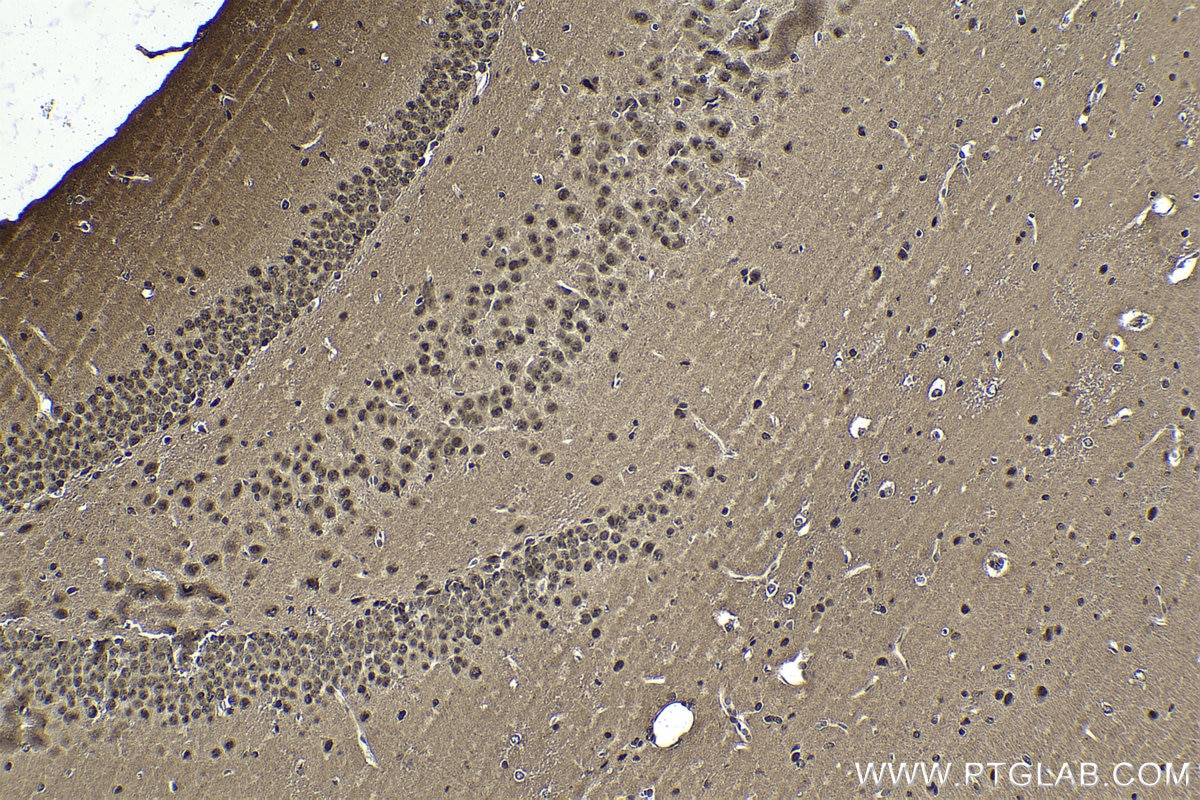 Immunohistochemistry (IHC) staining of mouse brain tissue using DDX1 Polyclonal antibody (11357-1-AP)