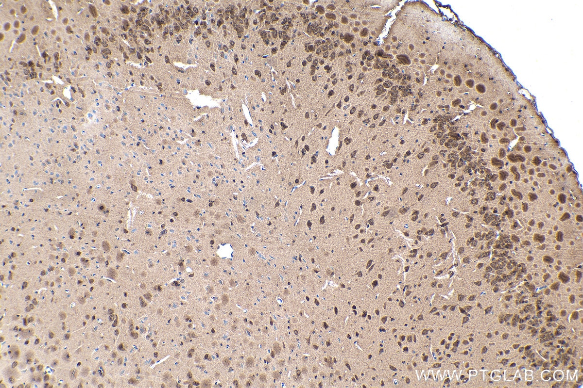Immunohistochemistry (IHC) staining of rat brain tissue using DDX1 Polyclonal antibody (11357-1-AP)