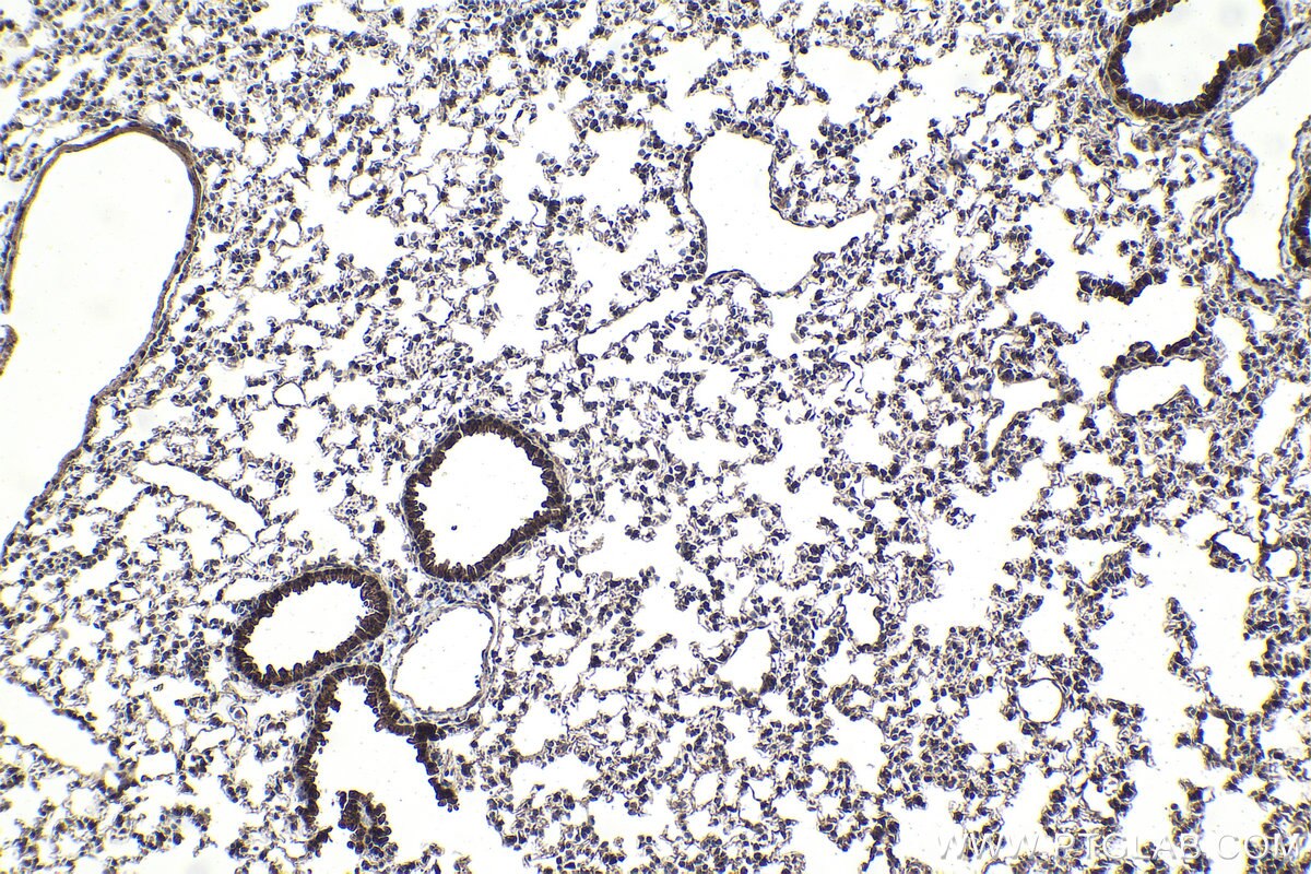 Immunohistochemistry (IHC) staining of mouse lung tissue using DDX1 Polyclonal antibody (11357-1-AP)