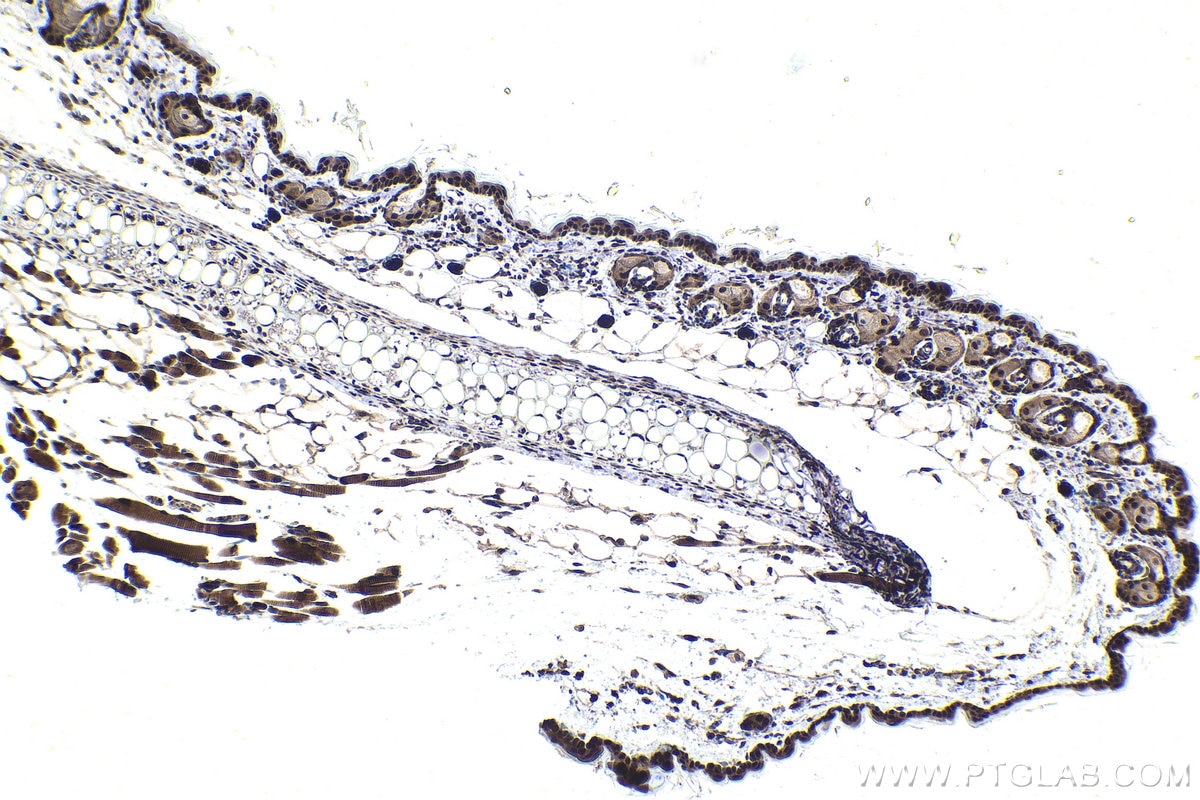 Immunohistochemistry (IHC) staining of mouse skin tissue using DDX1 Polyclonal antibody (11357-1-AP)