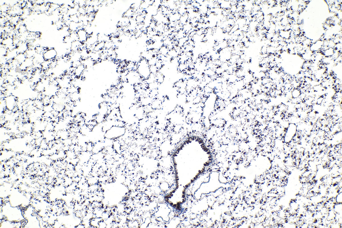 Immunohistochemistry (IHC) staining of rat lung tissue using DDX1 Polyclonal antibody (11357-1-AP)