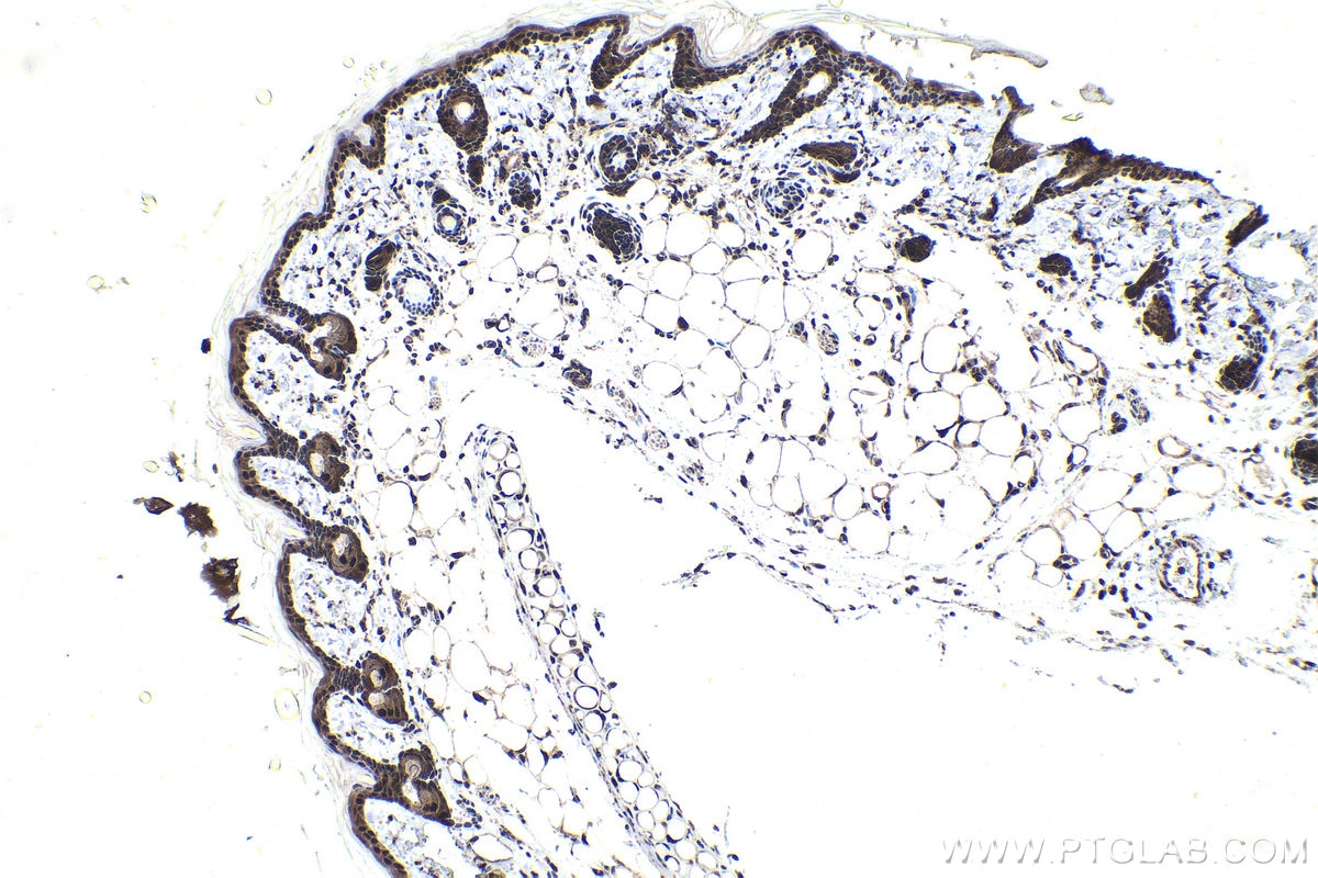 IHC staining of rat skin using 11357-1-AP