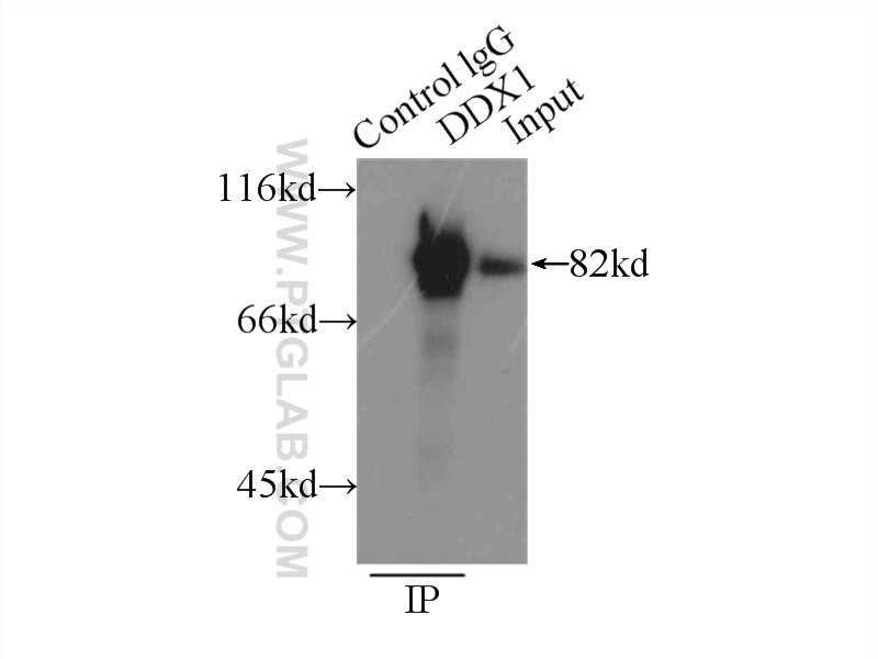 Immunoprecipitation (IP) experiment of PC-3 cells using DDX1 Polyclonal antibody (11357-1-AP)