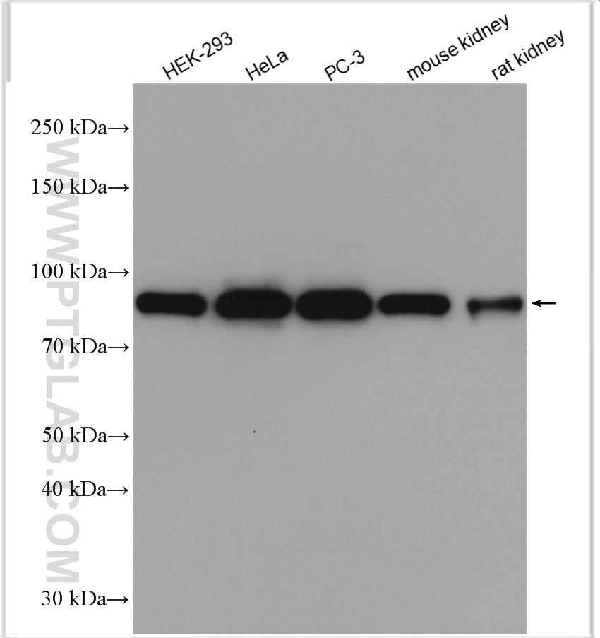 Western Blot (WB) analysis of various lysates using DDX1 Polyclonal antibody (11357-1-AP)