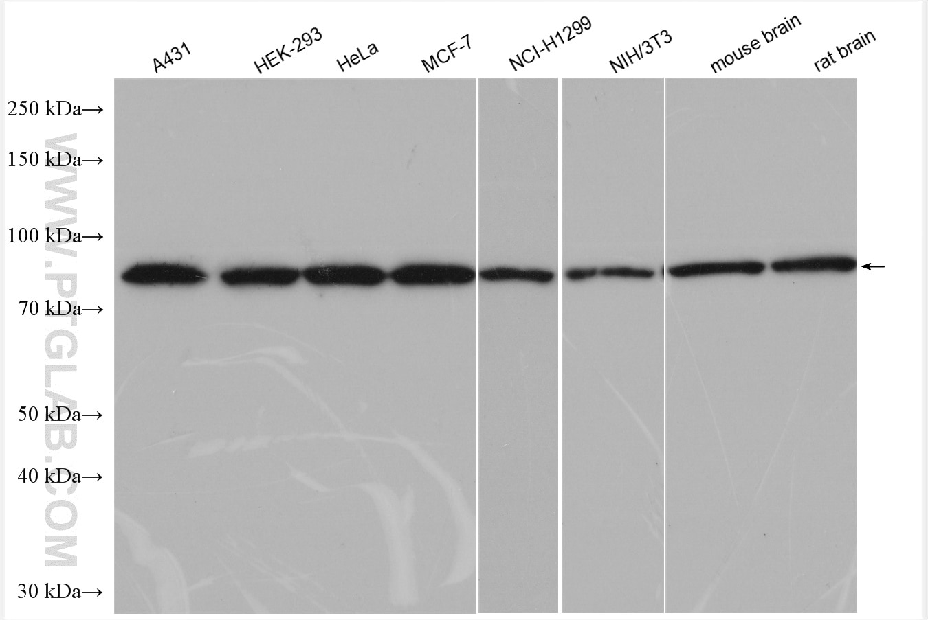 Western Blot (WB) analysis of various lysates using DDX1 Polyclonal antibody (11357-1-AP)