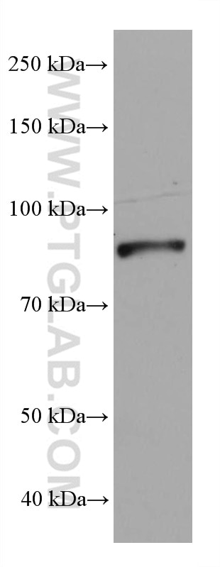 Western Blot (WB) analysis of 4T1 cells using DDX1 Monoclonal antibody (67991-1-Ig)