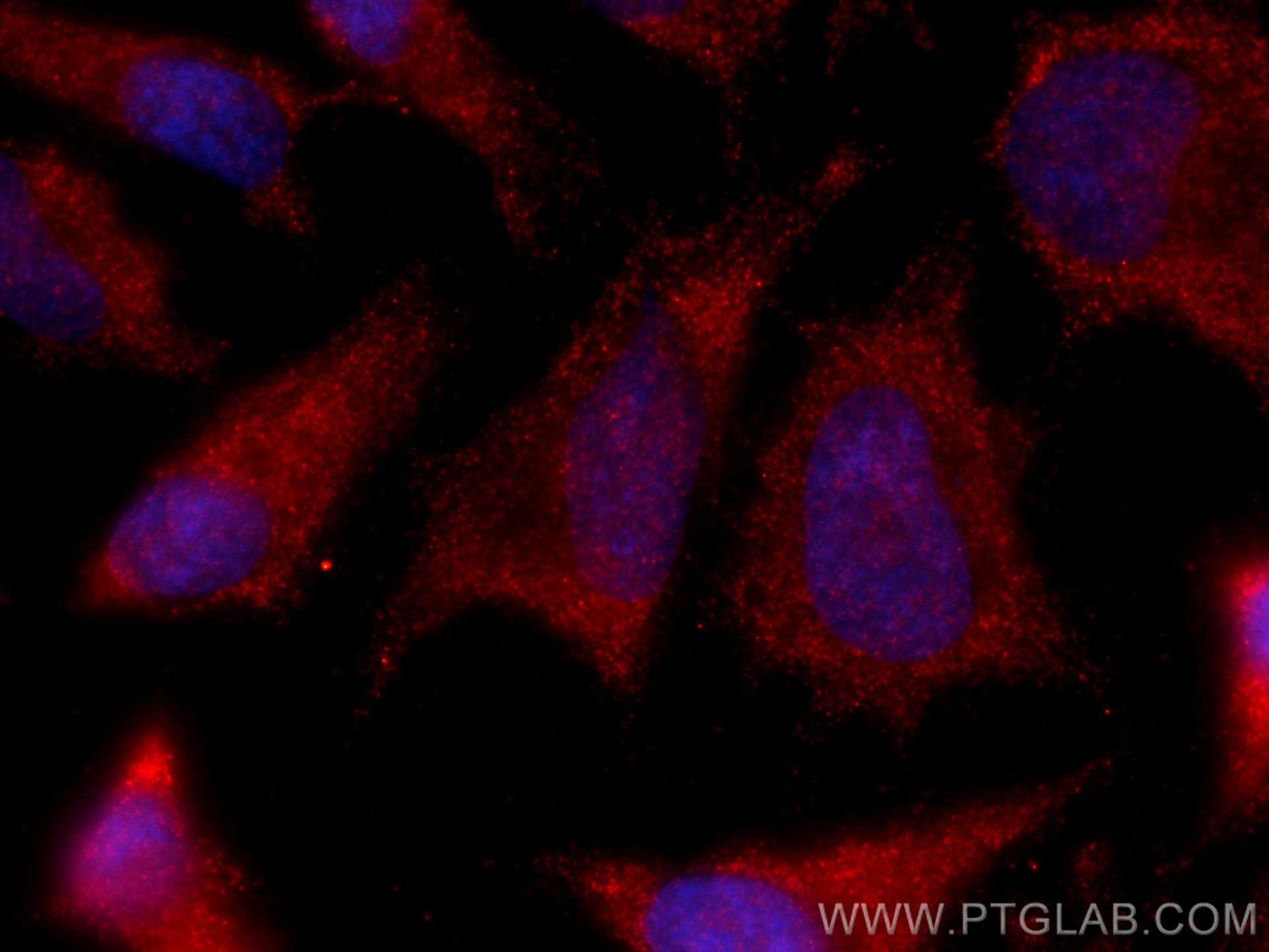 Immunofluorescence (IF) / fluorescent staining of HeLa cells using CoraLite®594-conjugated DDX1 Monoclonal antibody (CL594-67991)