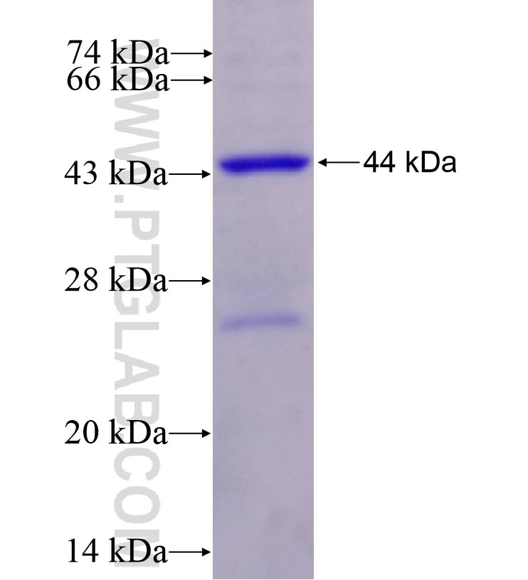 DDX1 fusion protein Ag16774 SDS-PAGE