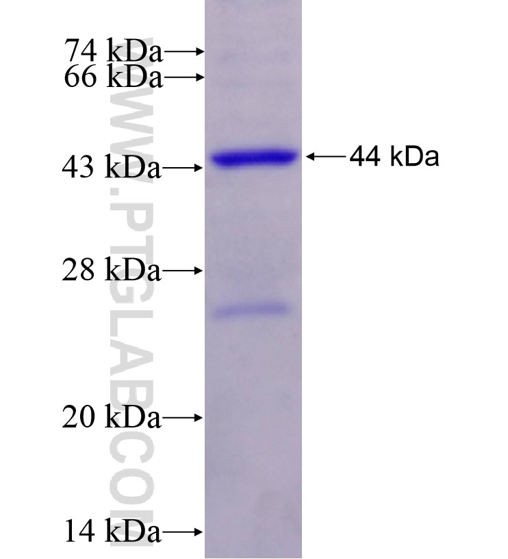 DDX1 fusion protein Ag16774 SDS-PAGE