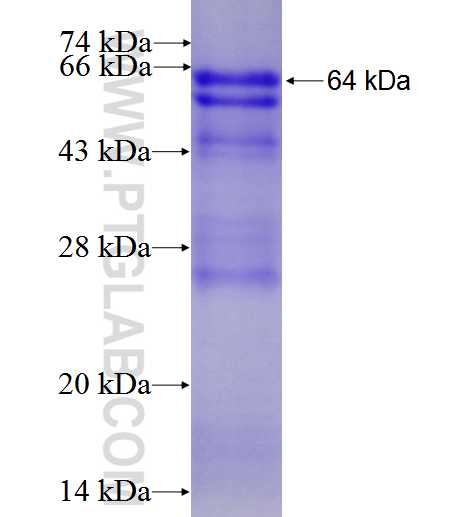 DDX1 fusion protein Ag1887 SDS-PAGE