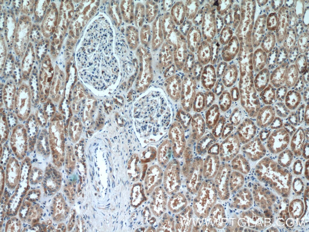 IHC staining of human kidney using 17857-1-AP