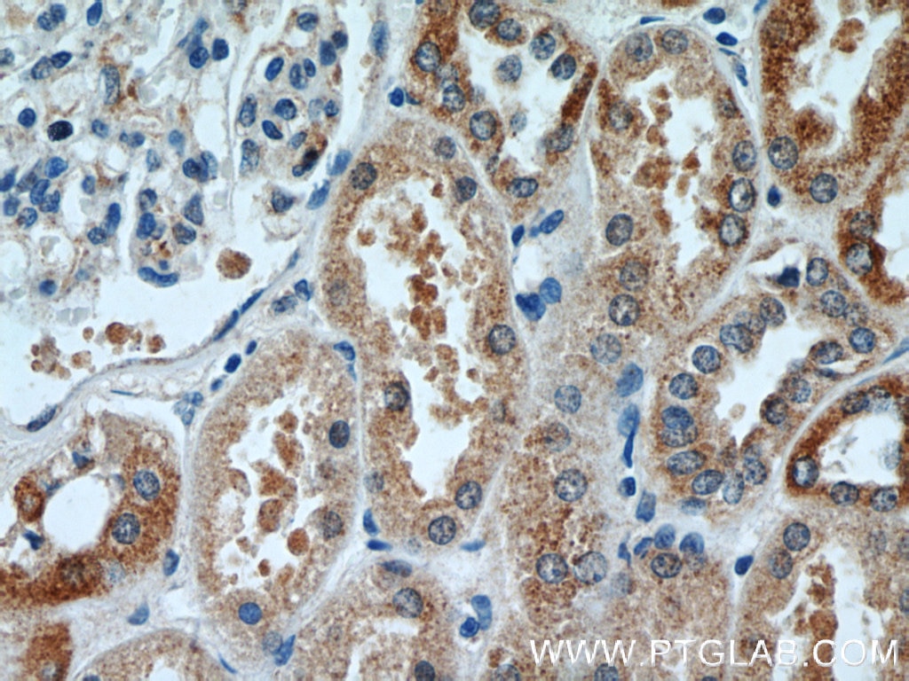 Immunohistochemistry (IHC) staining of human kidney tissue using DDX10 Polyclonal antibody (17857-1-AP)