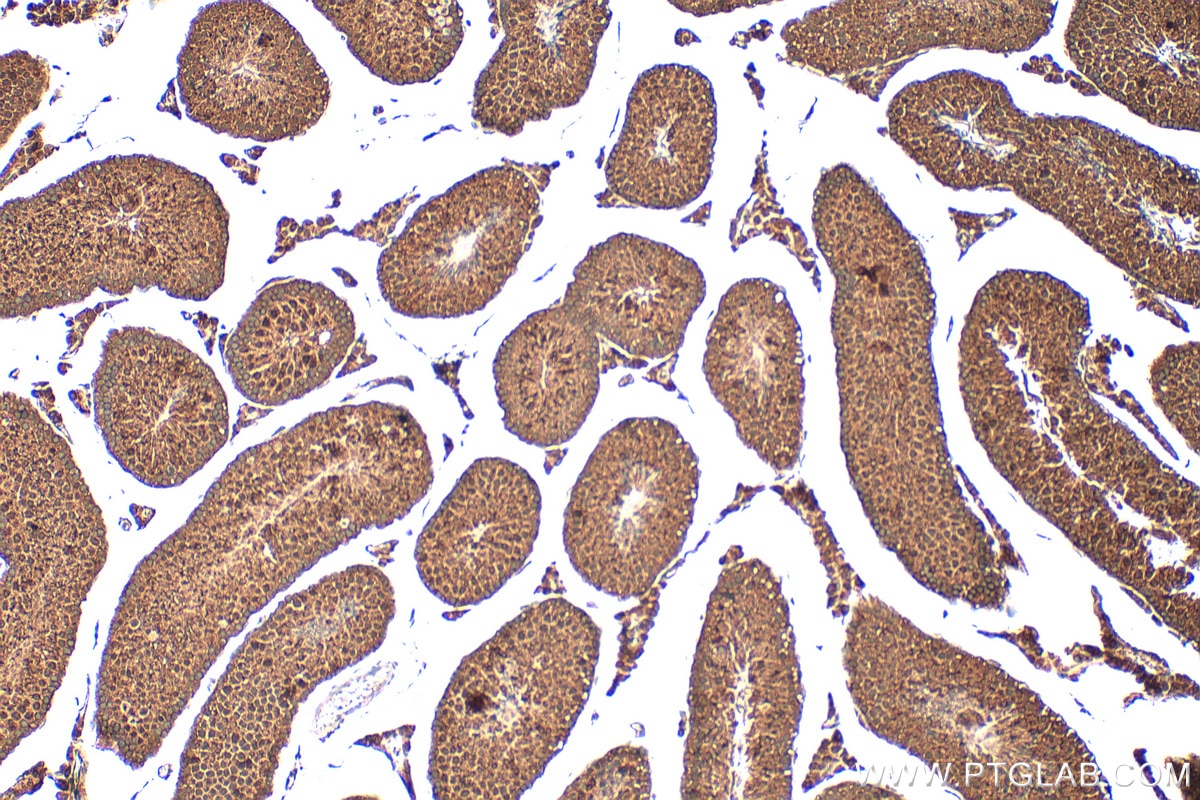 Immunohistochemistry (IHC) staining of mouse testis tissue using DDX10 Polyclonal antibody (17857-1-AP)