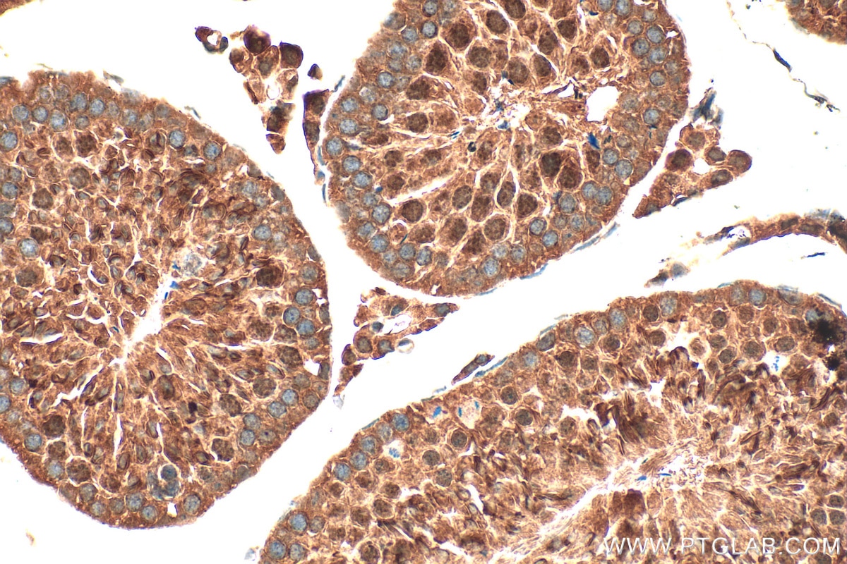 IHC staining of mouse testis using 17857-1-AP