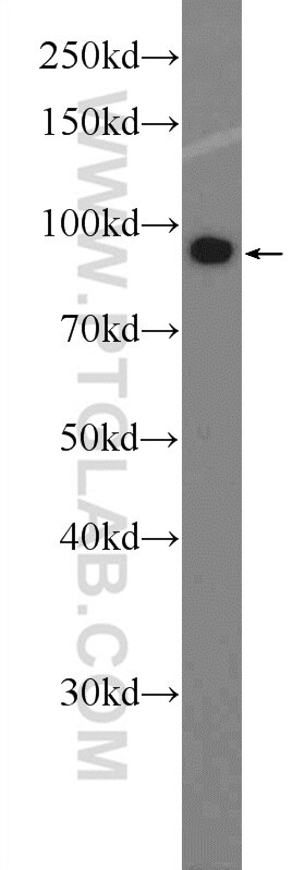 Western Blot (WB) analysis of HeLa cells using DDX10 Polyclonal antibody (17857-1-AP)