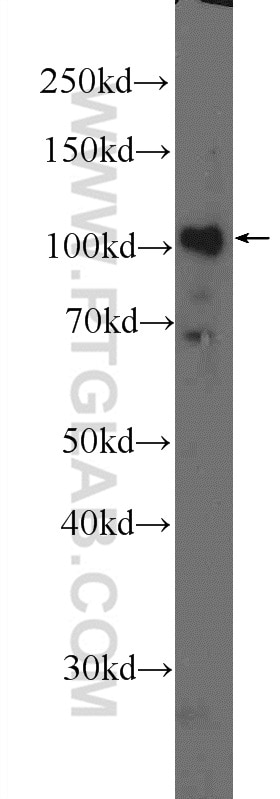 Western Blot (WB) analysis of SMMC-7721 cells using DDX10 Polyclonal antibody (17857-1-AP)