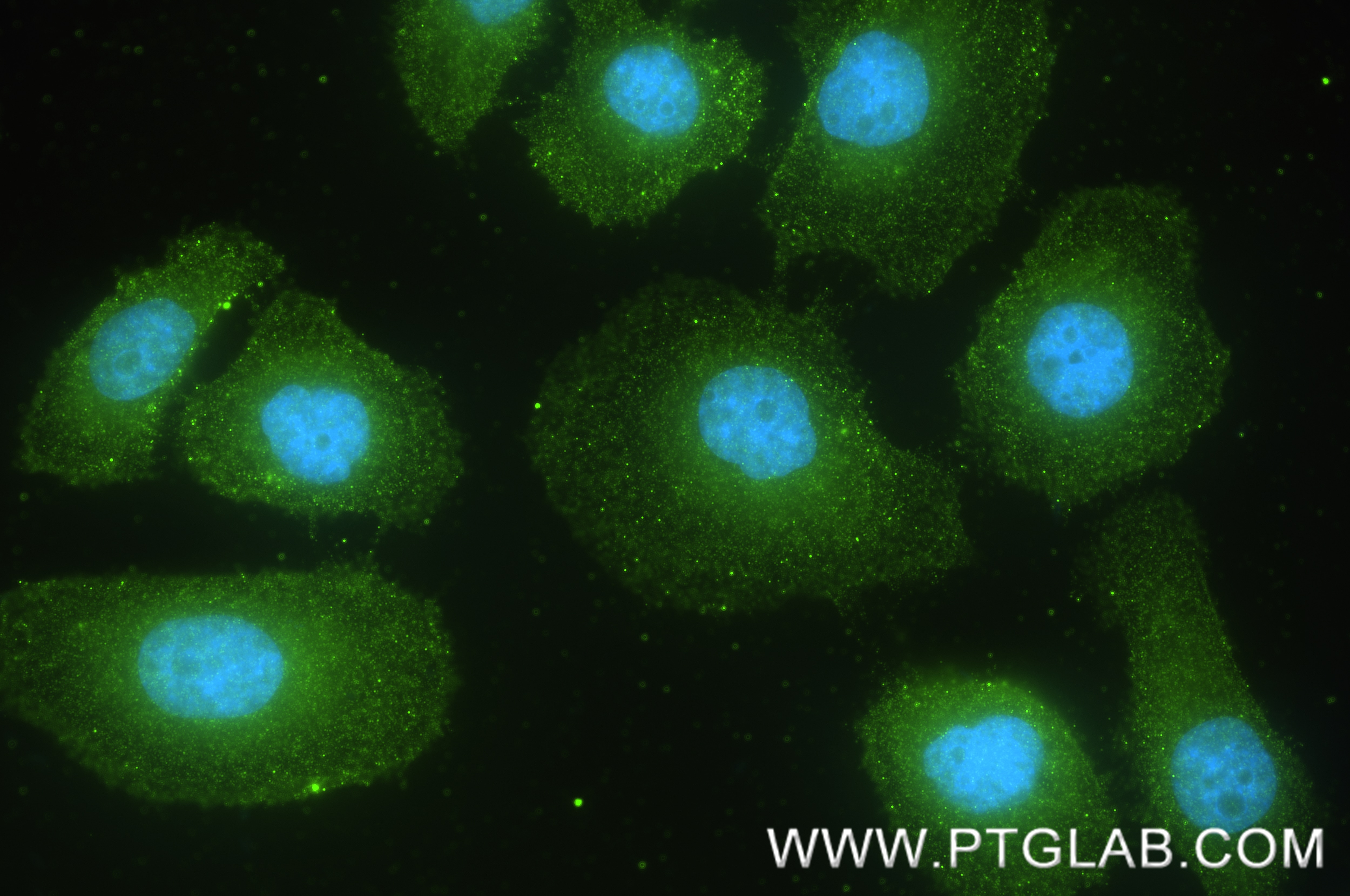 Immunofluorescence (IF) / fluorescent staining of SGC-7901 cells using DDX10 Recombinant monoclonal antibody (85709-1-RR)