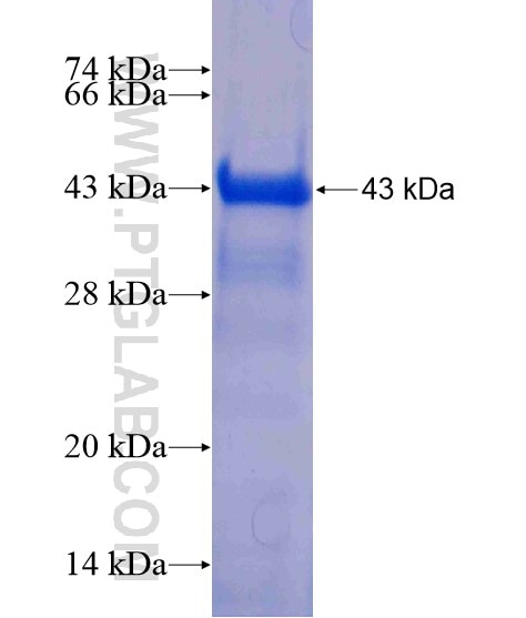 DDX10 fusion protein Ag20766 SDS-PAGE