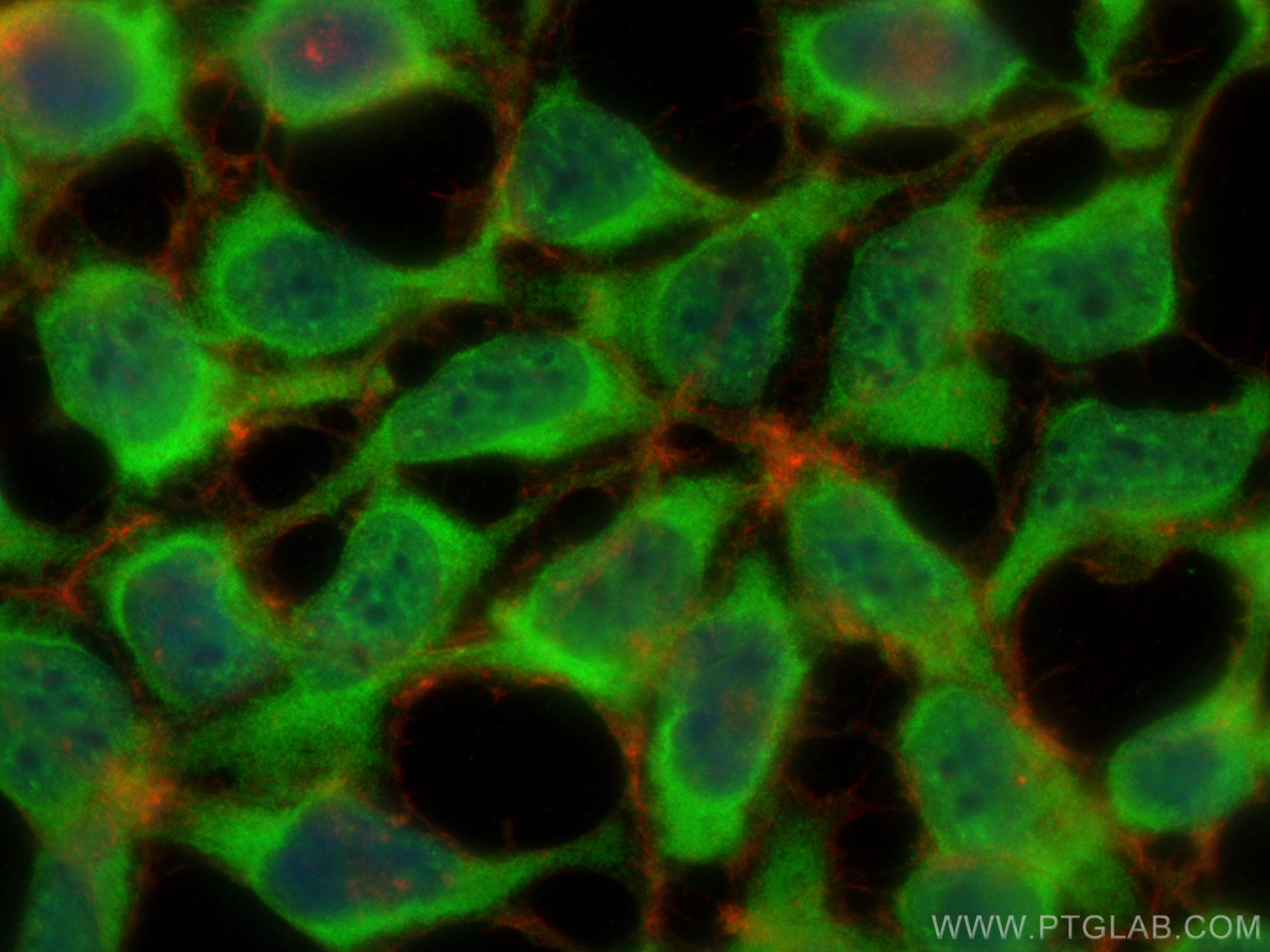 Immunofluorescence (IF) / fluorescent staining of HEK-293 cells using DDX17 Polyclonal antibody (19910-1-AP)
