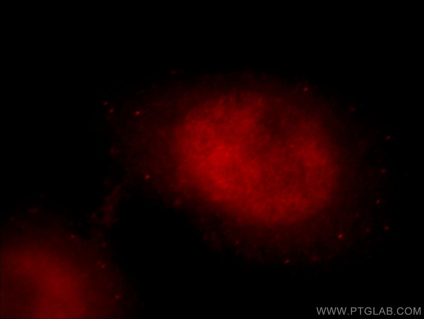 Immunofluorescence (IF) / fluorescent staining of HeLa cells using DDX17 Polyclonal antibody (19910-1-AP)