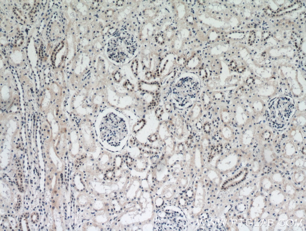 Immunohistochemistry (IHC) staining of human kidney tissue using DDX17 Polyclonal antibody (19910-1-AP)