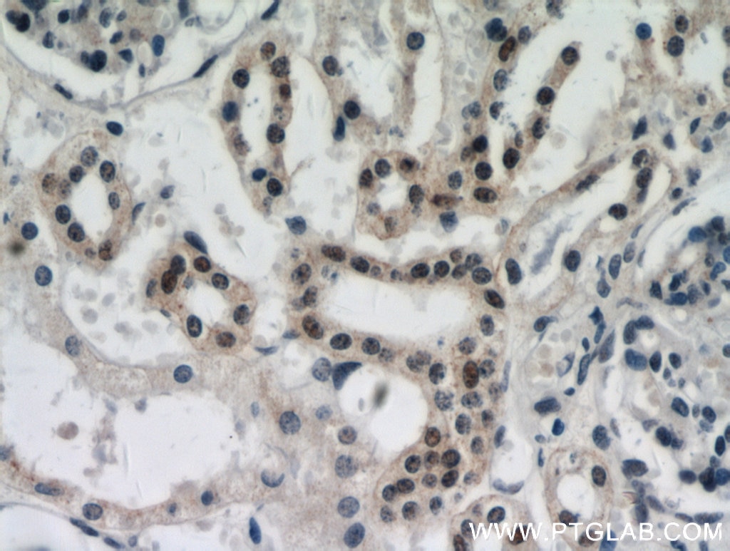 Immunohistochemistry (IHC) staining of human kidney tissue using DDX17 Polyclonal antibody (19910-1-AP)