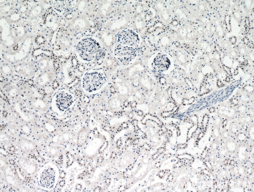 Immunohistochemistry (IHC) staining of human kidney tissue using DDX17 Polyclonal antibody (19910-1-AP)