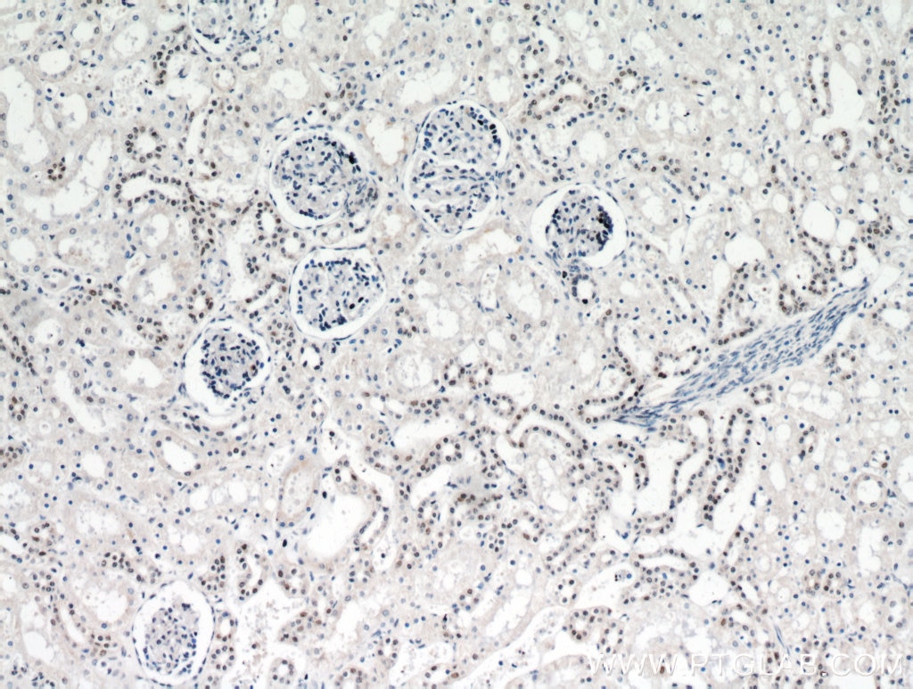 IHC staining of human kidney using 19910-1-AP