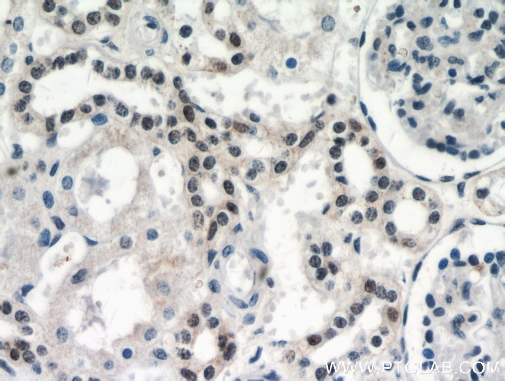 Immunohistochemistry (IHC) staining of human kidney tissue using DDX17 Polyclonal antibody (19910-1-AP)