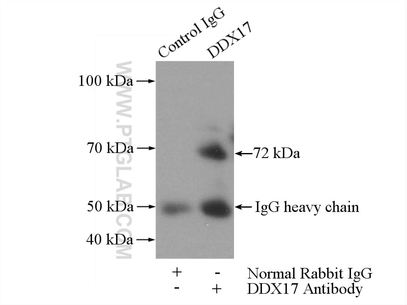 Immunoprecipitation (IP) experiment of mouse brain tissue using DDX17 Polyclonal antibody (19910-1-AP)