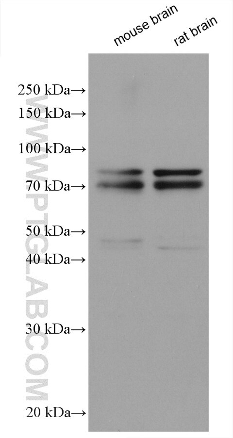 Western Blot (WB) analysis of various lysates using DDX17 Polyclonal antibody (19910-1-AP)