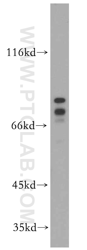 Western Blot (WB) analysis of HEK-293 cells using DDX17 Polyclonal antibody (19910-1-AP)