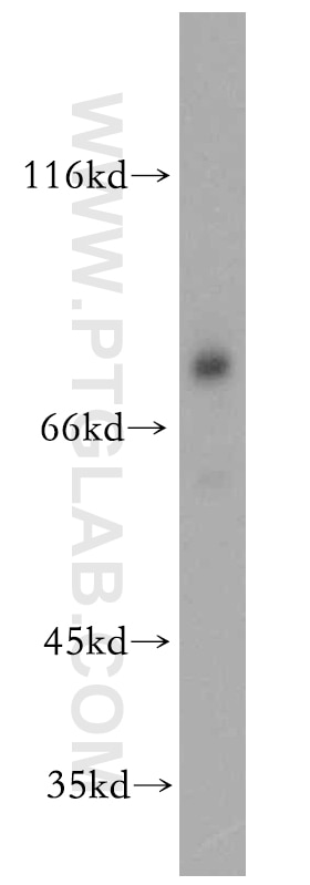 Western Blot (WB) analysis of mouse brain tissue using DDX17 Polyclonal antibody (19910-1-AP)