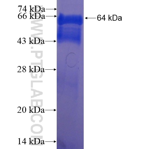 DDX17,P72 fusion protein Ag13723 SDS-PAGE