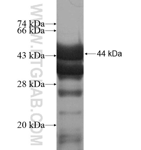 DDX17,P72 fusion protein Ag13777 SDS-PAGE