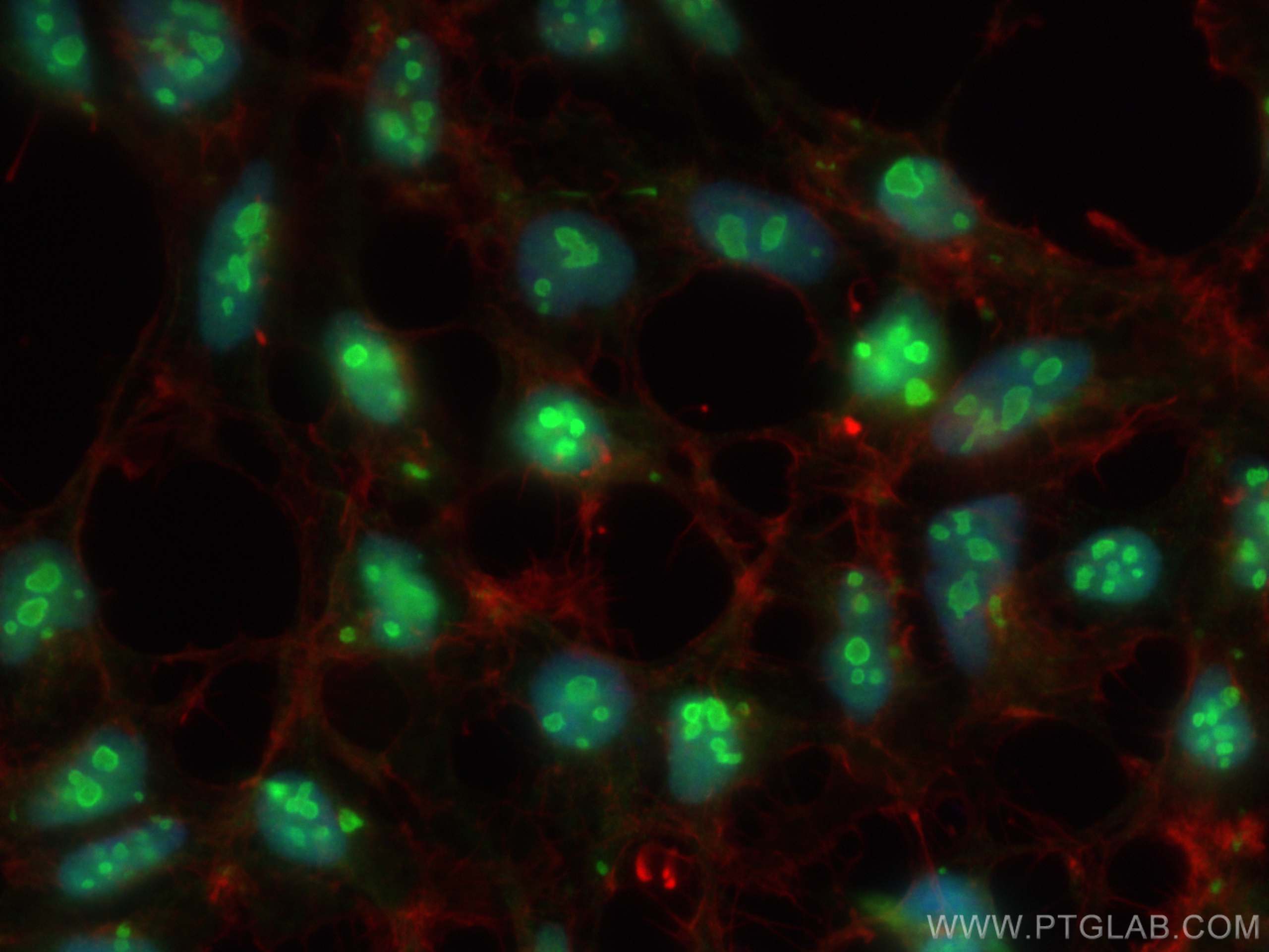 Immunofluorescence (IF) / fluorescent staining of HEK-293 cells using DDX18 Polyclonal antibody (28502-1-AP)
