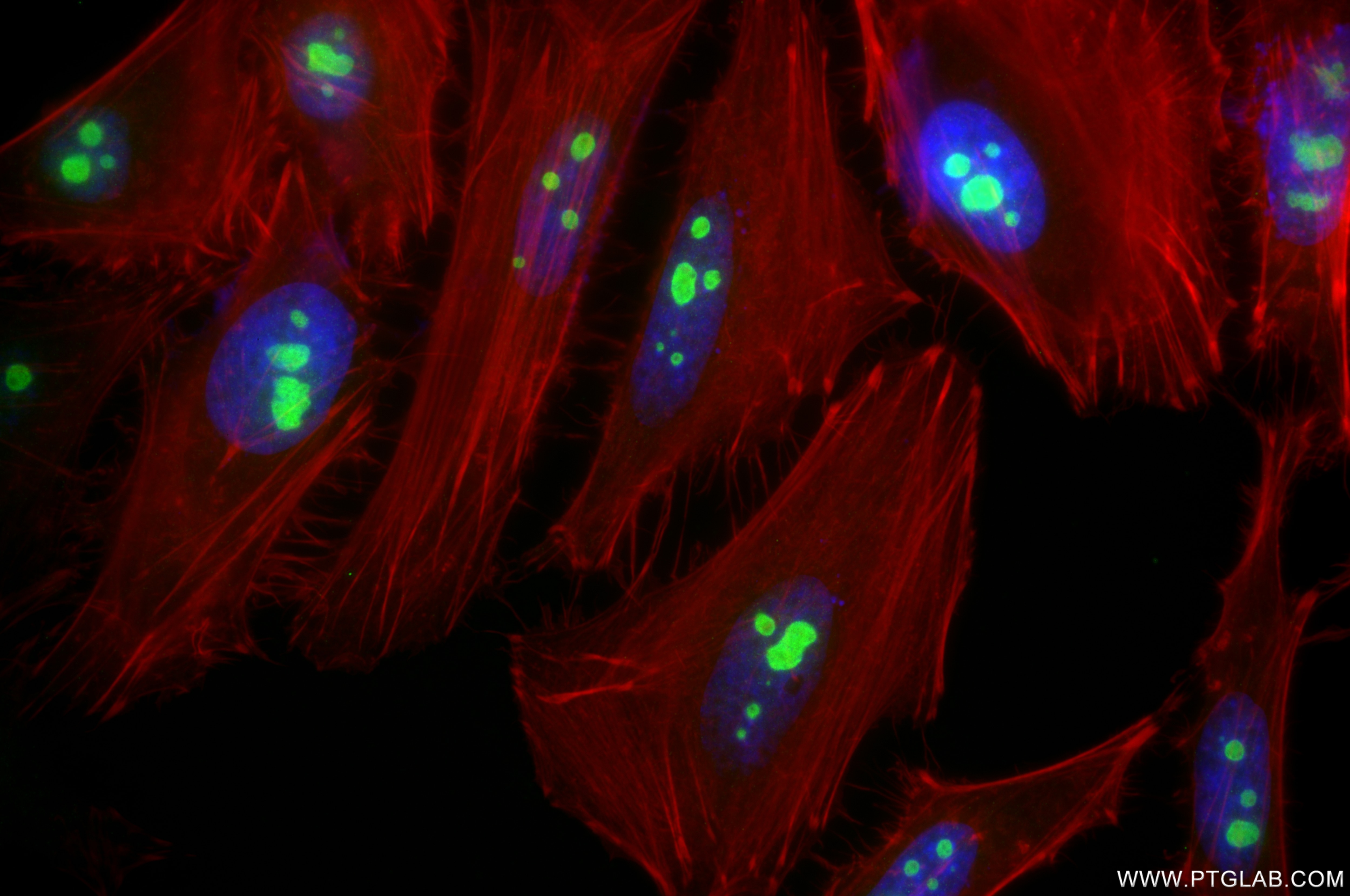 Immunofluorescence (IF) / fluorescent staining of HeLa cells using DDX18 Recombinant antibody (85789-2-RR)