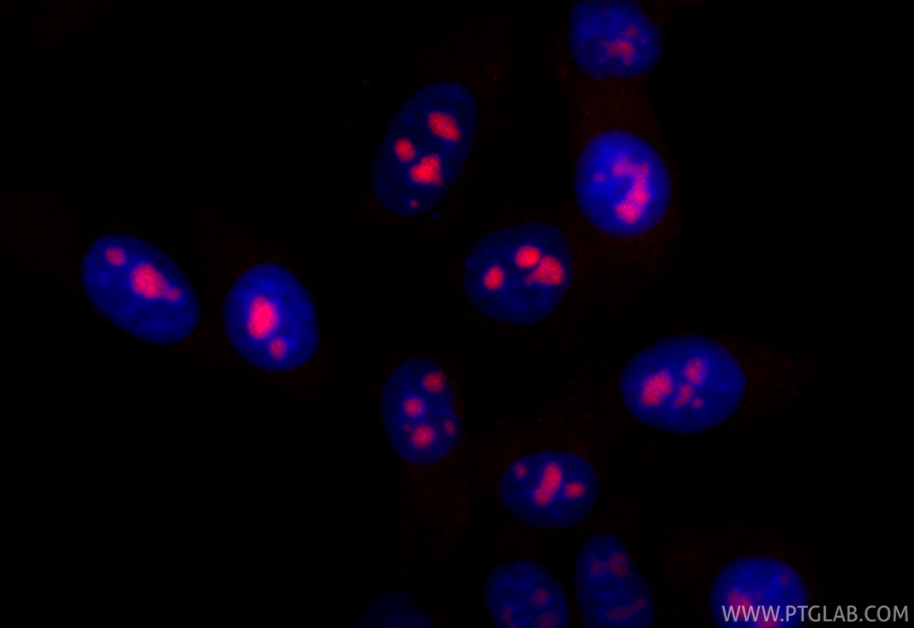 Immunofluorescent analysis of (4% PFA) fixed HepG2 cells using CoraLite®594 DDX18 antibody (CL594-85789-2, Clone: 250053A4 ) at dilution of 1:1000. Immunofluorescence (IF) / fluorescent staining of HepG2 cells using CoraLite®594-conjugated DDX18 Recombinant monoclon (CL594-85789-2)