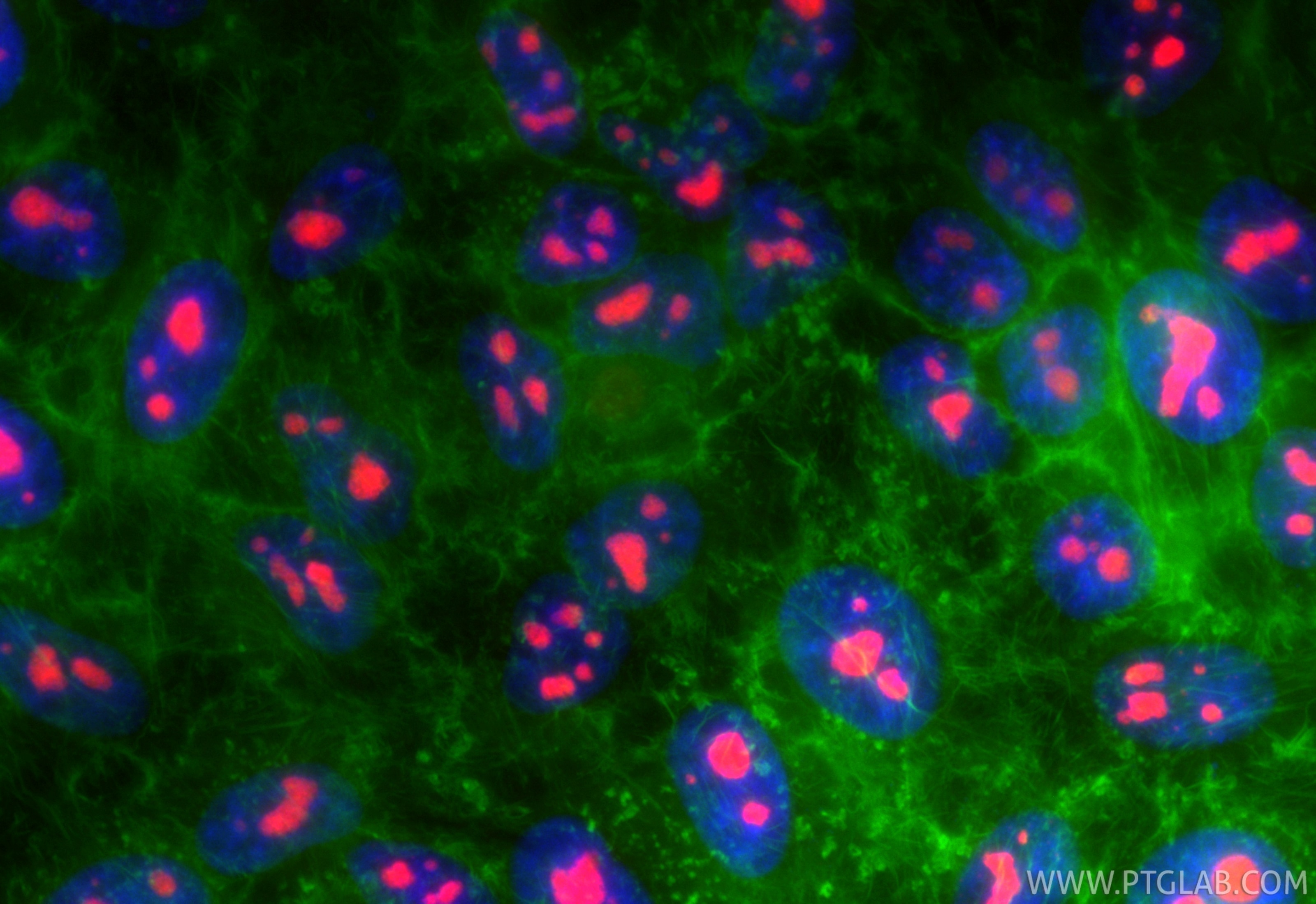 Immunofluorescence (IF) / fluorescent staining of HepG2 cells using CoraLite®594-conjugated DDX18 Recombinant antibody (CL594-85789-3)
