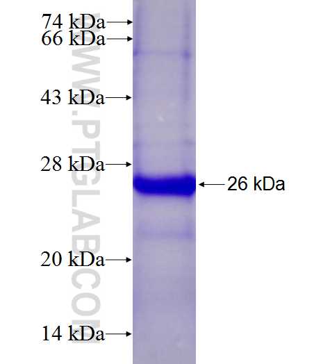 DDX18 fusion protein Ag27423 SDS-PAGE