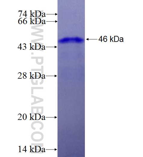 DDX18 fusion protein Ag27457 SDS-PAGE