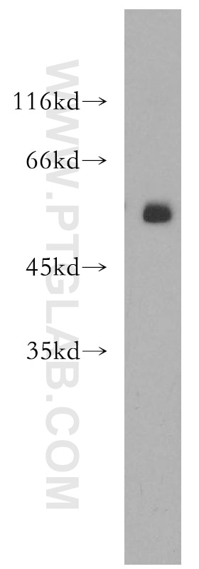 Western Blot (WB) analysis of K-562 cells using DDX19B Polyclonal antibody (18285-1-AP)